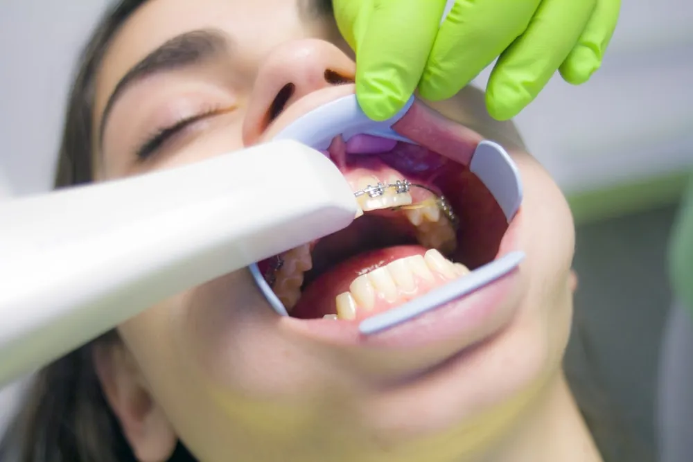 6 překvapivých návyků, které vedou ke žloutnutí zubů